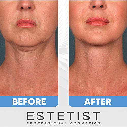 V Shaped Slimming Face Mask - Double Chin Reducer, Face Lift Tape Tightening Mask - Anti Aging, Anti Wrinkle, Firming, Jawline Slimmer (5 Pack)