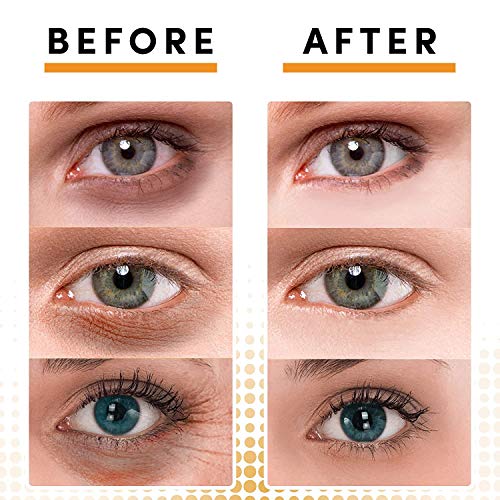 Under Eye Patches Eye Mask for Puffy Eyes, Dark Circles and Under Eye Bags Treatment With Hyaluronic Acid and Snail Slime Extract…
