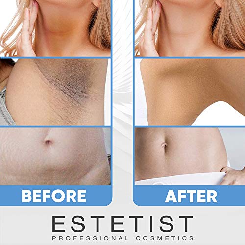 Skin Brightener Gel for Body, Face, Bikini and Sensitive Areas - Dark Spot Remover Cream